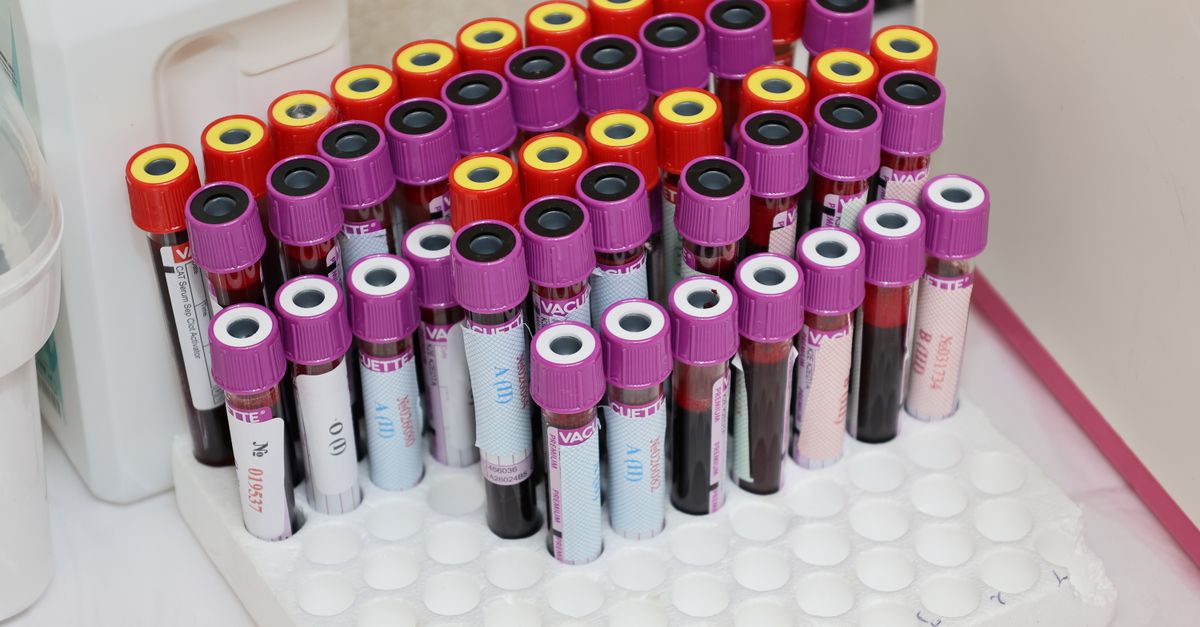 The Beta hCG Test: What That Number Actually Tells You