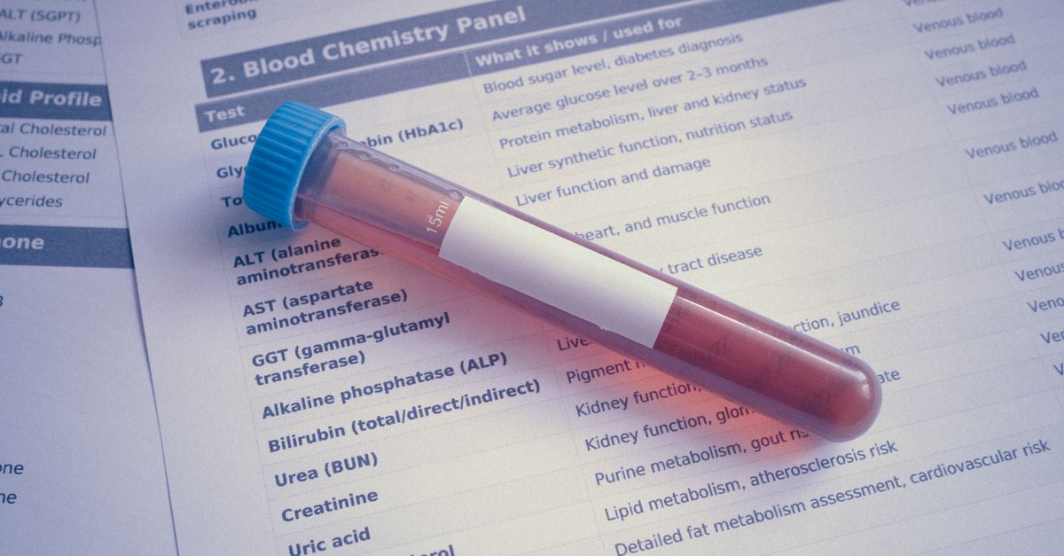 Laboratory equipment used for processing blood tests